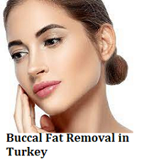 Buccal Fat Removal in Turkey