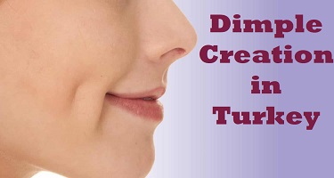 Dimple Creation in Turkey