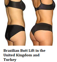 Brazilian Butt Lift in the United Kingdom and Turkey