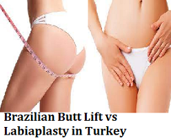 Brazilian Butt Lift vs Labiaplasty in Turkey