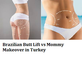 Brazilian Butt Lift vs Mommy Makeover in Turkey