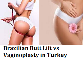 Brazilian Butt Lift vs Vaginoplasty in Turkey