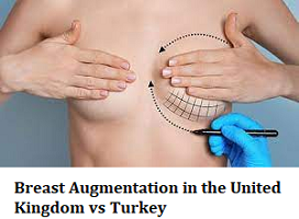 Breast Augmentation in the United Kingdom vs Turkey