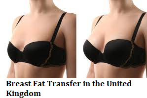 Breast Fat Transfer in the United Kingdom