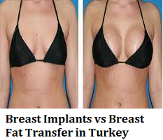 Breast Implants vs Breast Fat Transfer in Turkey