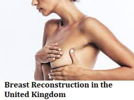 Breast Reconstruction in the United Kingdom