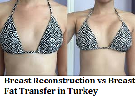 Breast Reconstruction vs Breast Fat Transfer in Turkey