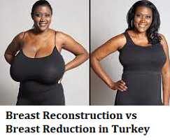 Breast Reconstruction vs Breast Reduction in Turkey