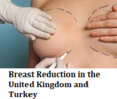 Breast Reduction in the United Kingdom and Turkey