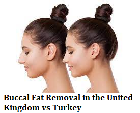 Buccal Fat Removal in the United Kingdom vs Turkey