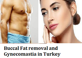 Buccal Fat removal and Gynecomastia in Turkey