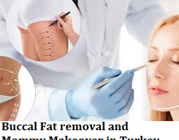 Buccal Fat removal and Mommy Makeover in Turkey