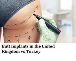Butt Implants in the United Kingdom vs Turkey