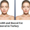 Facelift and Buccal Fat Removal in Turkey