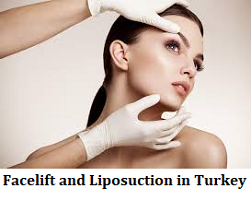 Facelift and Liposuction in Turkey
