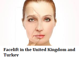Facelift in the United Kingdom and Turkey