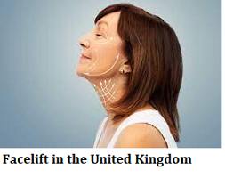 Facelift in the United Kingdom