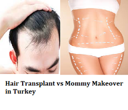 Hair Transplant vs Mommy Makeover in Turkey