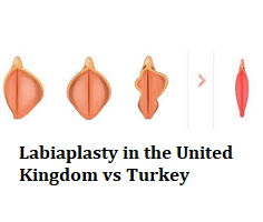 Labiaplasty in the United Kingdom vs Turkey