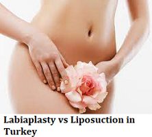 Labiaplasty vs Liposuction in Turkey