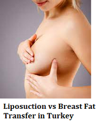 Liposuction vs Breast Fat Transfer in Turkey