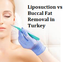 Liposuction vs Buccal Fat Removal in Turkey