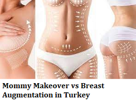 Mommy Makeover vs Breast Augmentation in Turkey