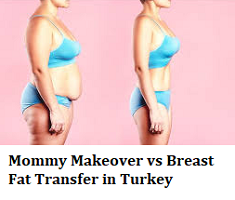 Mommy Makeover vs Breast Fat Transfer in Turkey