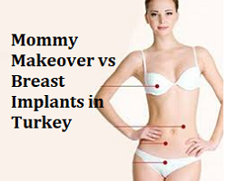 Mommy Makeover vs Breast Implants in Turkey