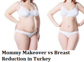 Mommy Makeover vs Breast Reduction in Turkey