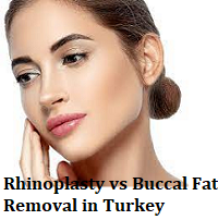 Rhinoplasty vs Buccal Fat Removal in Turkey