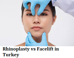 Rhinoplasty vs Facelift in Turkey