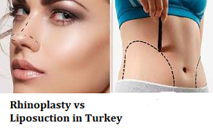 Rhinoplasty vs Liposuction in Turkey