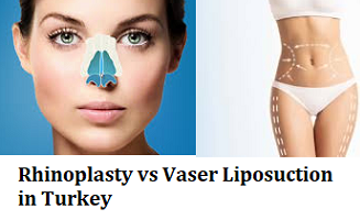 Rhinoplasty vs Vaser Liposuction in Turkey