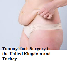 Tummy Tuck Surgery in the United Kingdom and Turkey