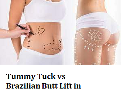 Tummy Tuck vs Brazilian Butt Lift in Turkey