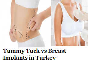 Tummy Tuck vs Breast Implants in Turkey