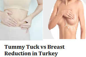 Tummy Tuck vs Breast Reduction in Turkey