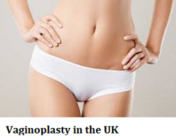 Vaginoplasty in the UK