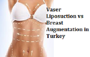 Vaser Liposuction vs Breast Augmentation in Turkey