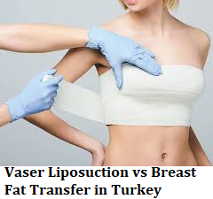 Vaser Liposuction vs Breast Fat Transfer in Turkey