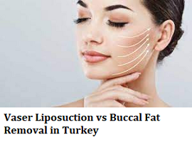 Vaser Liposuction vs Buccal Fat Removal in Turkey